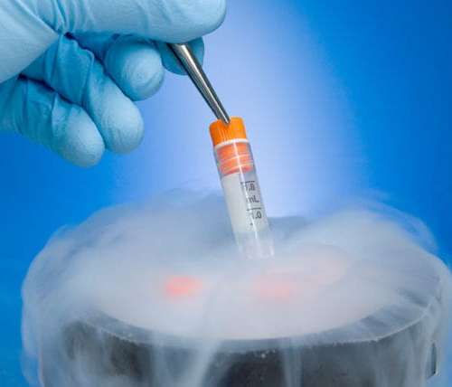 Egg freezing- The technique makes it easy to become a mother in old age