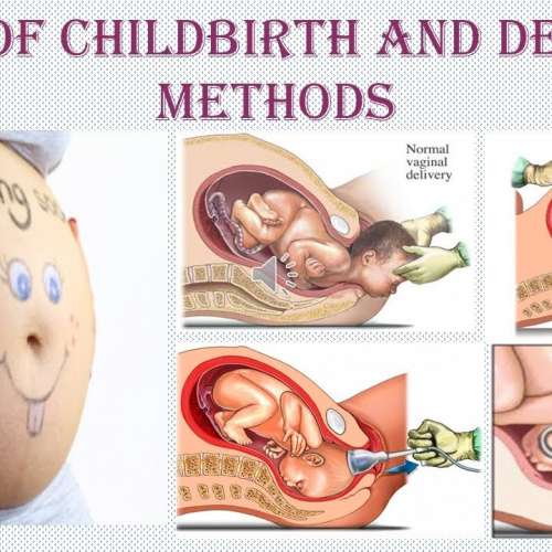 Types of Childbirth and Delivery Methods You Should Know