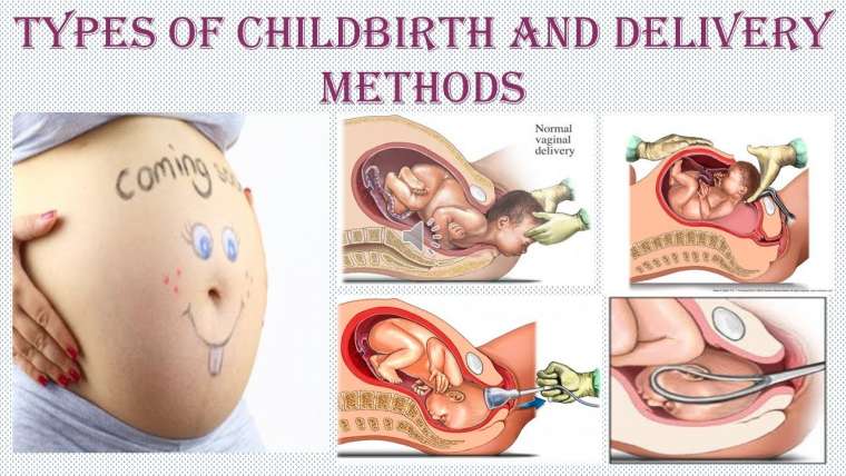 Types of Childbirth and Delivery Methods You Should Know
